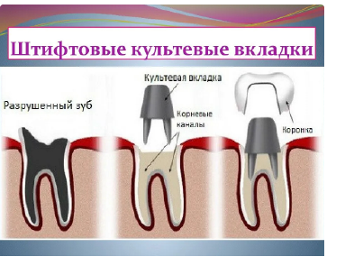 Протезирование зубов в Лазаревском